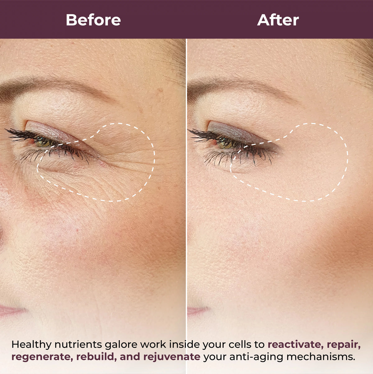 Under Eye Serum 3 Bottles I4876